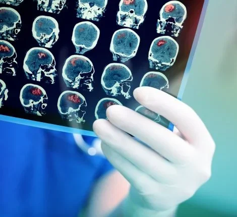 A scientist holds up a brain MRI image.