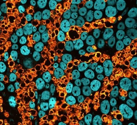 A magnified image of muscle cells with some coloration.