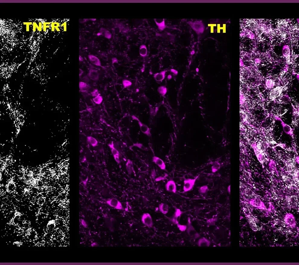 (From left) These images show midbrain dopamine neurons expressing TNF receptor 1 (TNFR), tyrosine hydroxylase (TH) and an extensive overlap of both.