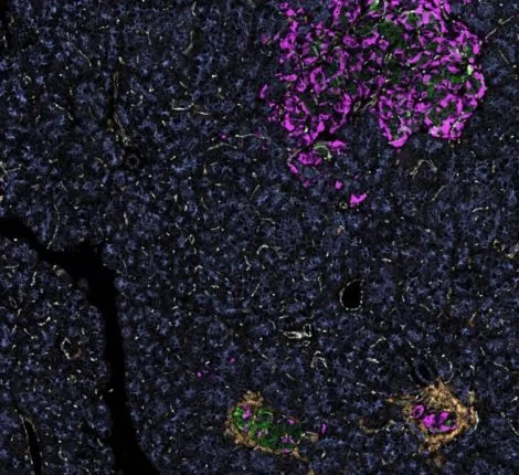 diabetes An extreme close-up of cells with diabetes